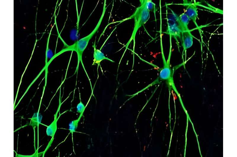 The researchers are joining a team called SSPsyGene with the joint goal of developing neurodevelopmental and psychiatric disease (NPD) genes targeting 250 high-risk genes. In the first phase of the project, the teams tested 23 NPD genes at risk. The resulting stem cell lines will be made available to other researchers around the world to help research genetic risk factors and their contribution to NPD. Credit: MiNND team Scientists are determined to identify the genetic roots of mental illness on a large scale